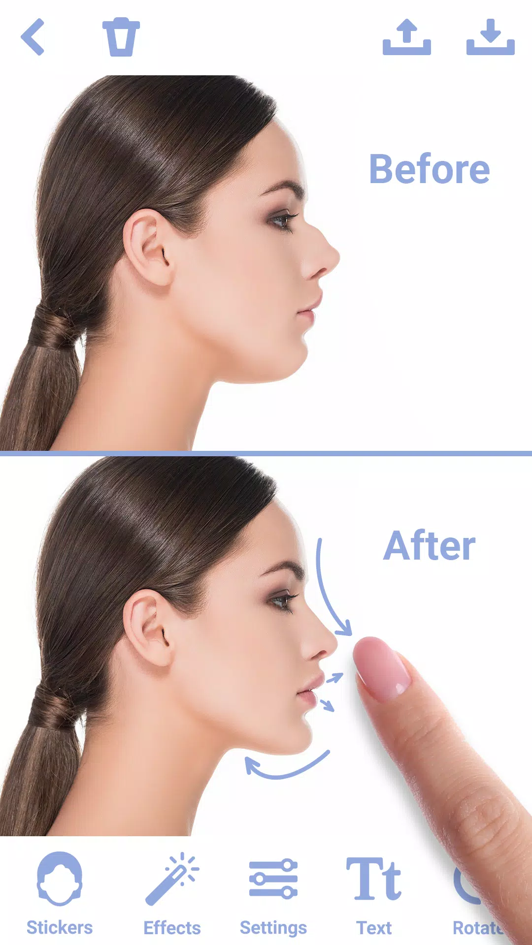 Rhinoplasty應用截圖第1張