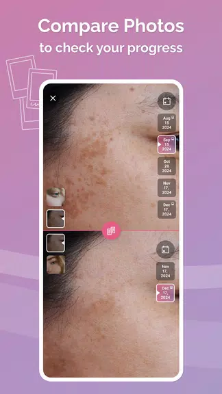 Schermata Skincare Routine: FeelinMySkin 3